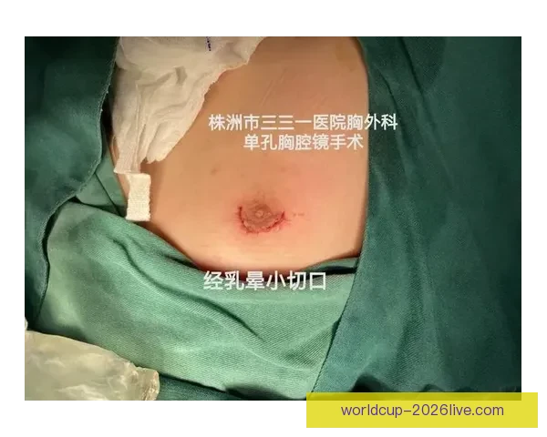 坎宁安气胸康复持续推进 活塞计划一周后复查评估